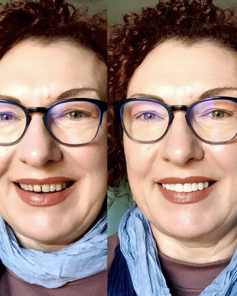 EARLEPS LuxeSmile Biyouyumlu Yeni Nesil Takma Dişler