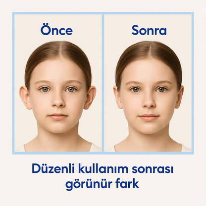 EARLEPS™ Kulak Bandı (20 Adet 3-4 Ay Kullanım İçin Uygun)